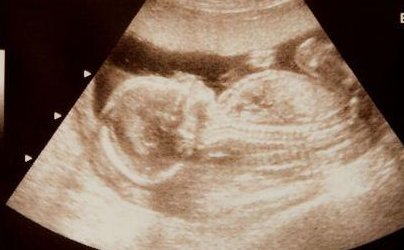 2026年上海不孕不育医疗机构盘点，揭秘3家试管婴儿优选医院