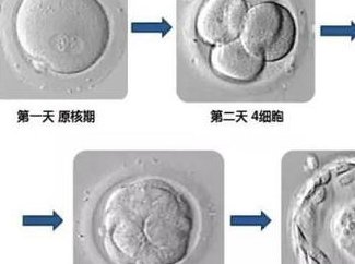 2026兰大一院试管费用介绍，排队时间不用太久